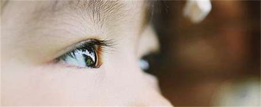 儿童眼睛发黄有血丝是什么原因