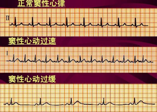 《情意回途》片子残破版