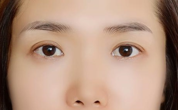 掉眉毛是什么征兆 掉眉毛是什么病的前期外现