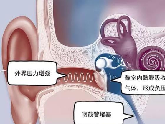 中耳炎是什么原因引起的 吸烟游泳免疫力下降感冒感染