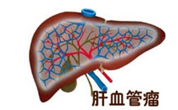 肝血管瘤严重吗？肝血管瘤的症状表现