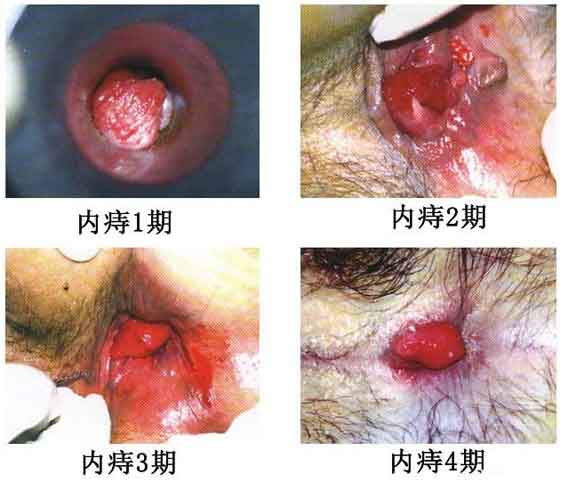 网游之无敌弓手最新章节