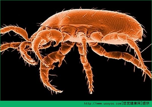 螨虫会不会传染？狗狗身上的螨虫会传染吗？(2)
