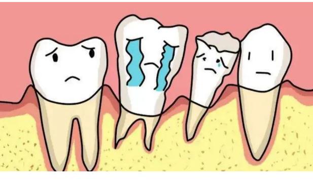 哪些牙齿需要拔掉 含氟牙膏对牙齿的作用
