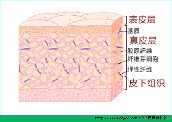 不同程度的冻疮 冻疮的病症告诉你你哪里冻伤