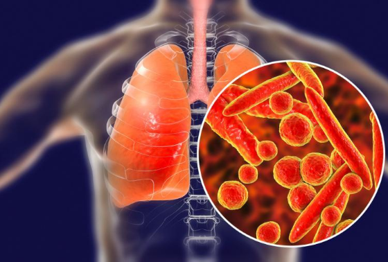 支原体肺炎会引起肺纤维化吗 支原体肺炎会引起肺空洞吗
