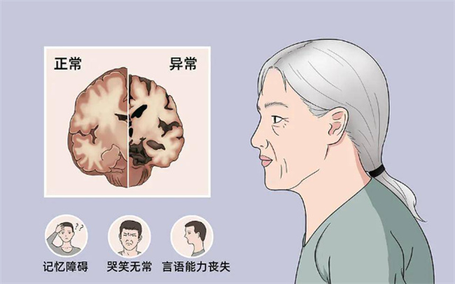 《少年忠细亚历克斯》电视剧