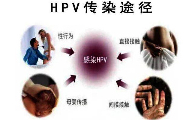 ​​HPV感染要谨记哪些能转阴，HPV感染要注意事项有哪些